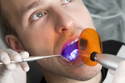 Laser Zahnarzt Anwendungsgebiete Bild 1